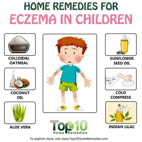 Home Remedies for Eczema in Children | Top 10 Home Remedies