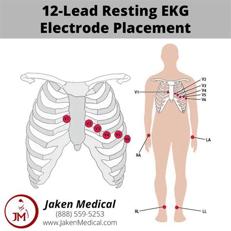 12-Lead Resting EKG Electrode Placement | Ekg leads, 12 lead ekg ...