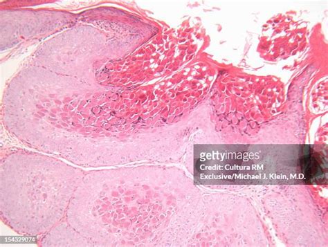 249 Epidermis Cells Stock Photos, High-Res Pictures, and Images - Getty ...