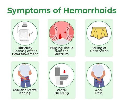 Piles Haemorrhoids Causes Symptoms And Treatment – NBKomputer