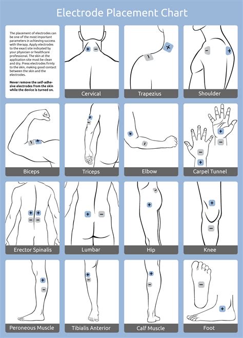 TENS Unit Placement Diagram Ideas Tens Unit Placement, Ten