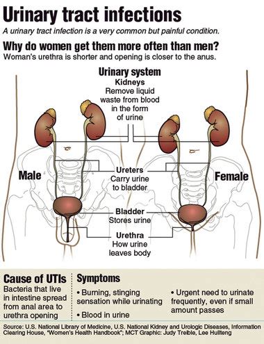 Multiple Sclerosis Research: UTI on Ampyra is not different