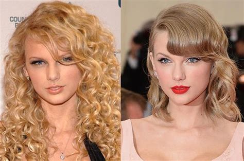 Taylor Swift before and after plastic surgery 05 | Celebrity plastic ...