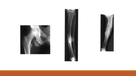 ORTHOPEDIC XRAYS.pptx