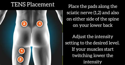 TENS Unit Placement For Sciatica Nerve Pain – Optimize Health 365