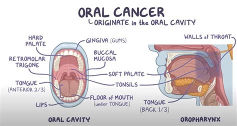 Oral Cancer Symptoms, Causes, Treatments, and More