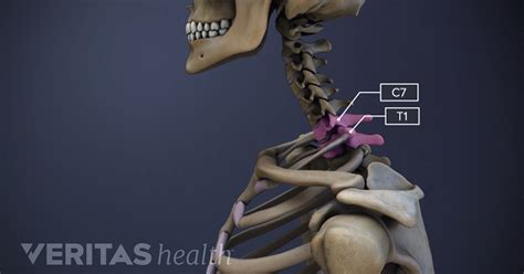 Spinal Motion Segment: C7-T1 (Cervicothoracic Junction) Animation