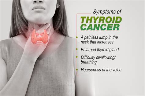 Symptoms of thyroid cancer