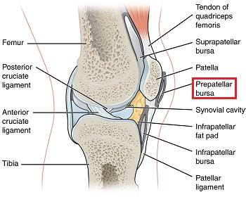 Prepatellar Bursitis: Symptoms, Treatment & Recovery | Study.com