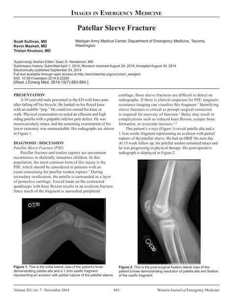 (PDF) Patellar Sleeve Fracture