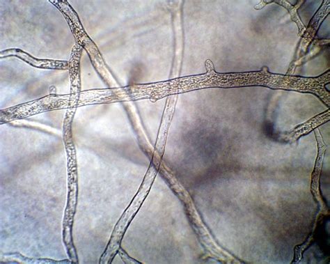 Non-Septate Hyphae (Coenocytic hyphae) | Medical Laboratories