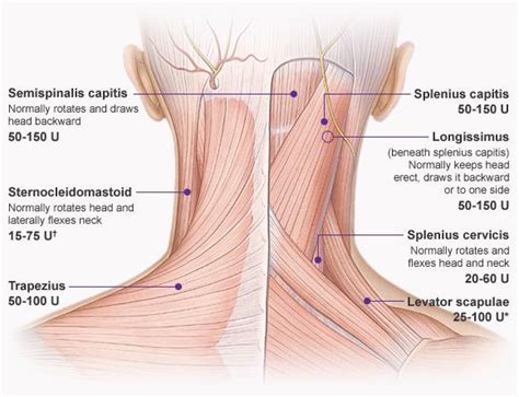 tension headache back of head - Nexus Sincere