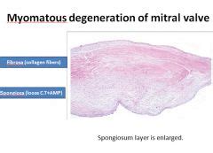 Mitral Valve Histology