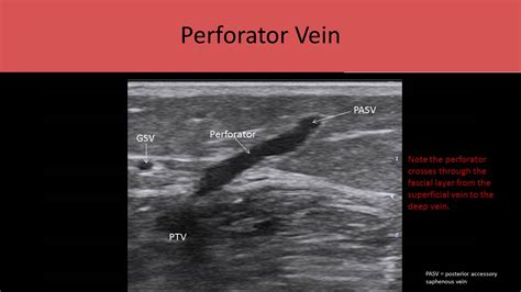 Ultrasound Registry Review - Extremity Venous