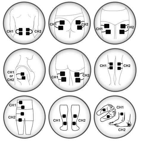 Tens Pad Placement Plessure Chart