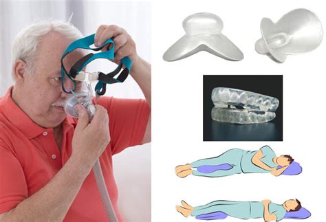 Alternatives to CPAP treatment