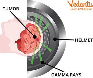 Uses of Gamma Rays - Learn Important Terms and Concepts