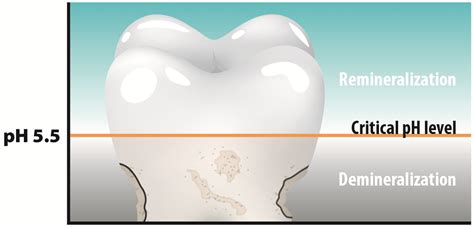 Protect Yourself From Tooth Decay: pH Neutralization | CariFree