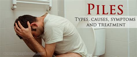 Piles - Types, causes, symptoms and treatment