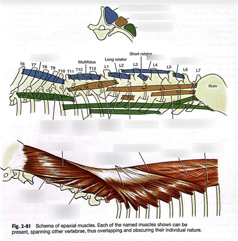 Anatomy - Epaxial muscles Diagram | Quizlet