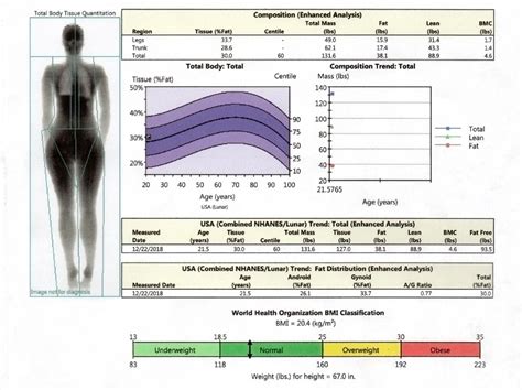 Bone Density Scan Results / Bone densitometry - The more bone material ...