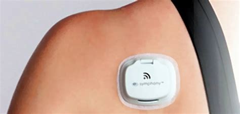 Another Wearable to Monitor Glucose Levels|Health Tech Insider