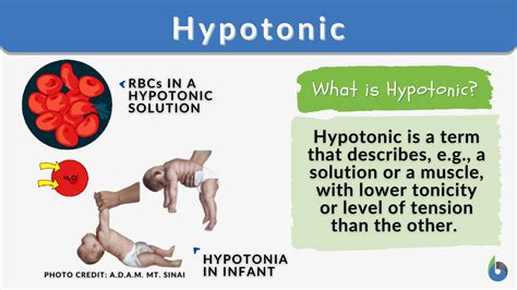 Hypotonic