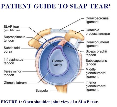 SLAP Tear Surgery and Recovery: November 2010