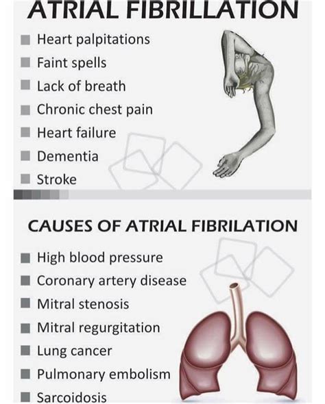 Symptoms and Causes of Atrial Fibrillation | Cardiac nursing, Medical ...