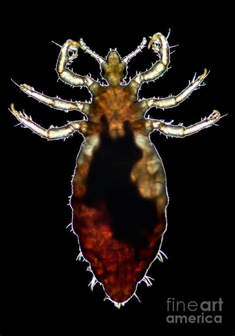 Body Louse Photograph by Science Source - Fine Art America