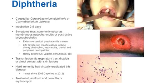 Understanding Diphtheria: Causes, Symptoms, And Treatment - Ask The ...