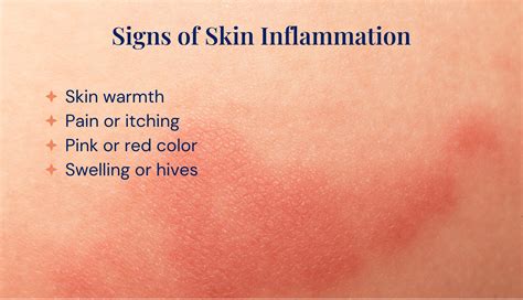 Skin Inflammation