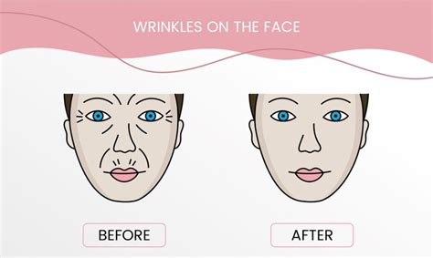 Premium Vector | Wrinkles on the face laser cosmetology before ...