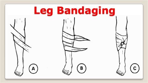 Bandaging Techniques