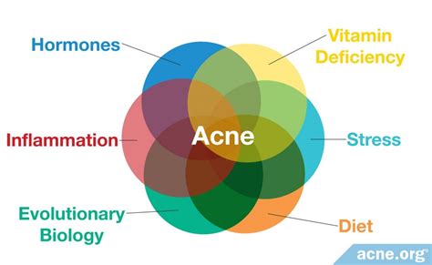 Causes of Acne - Acne.org