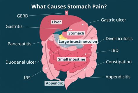 Abdominal Pain: Causes, Treatment, Risks, 44% OFF