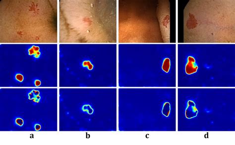 Segmentation of Angiodysplasia colonoscopy images on sampled test ...