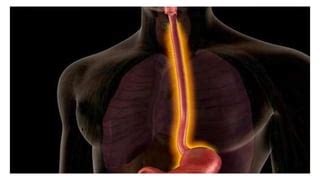 Esophagitis: Symptoms, Causes and Treatment | PPT