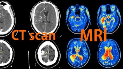 CT Scan and MRI result [2] | Download Scientific Diagram