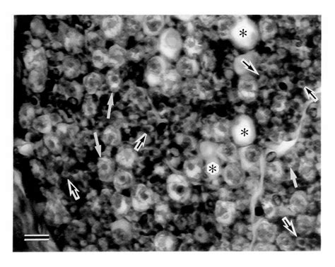 Figure 1 from Unmyelinated nerve fibers of the human mandibular nerve ...