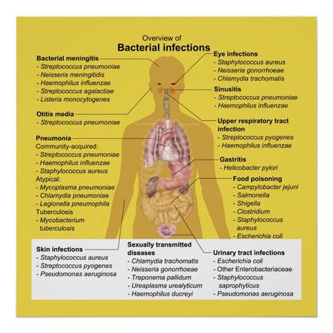 Best Example Of Viral Infection Famous - News Blog