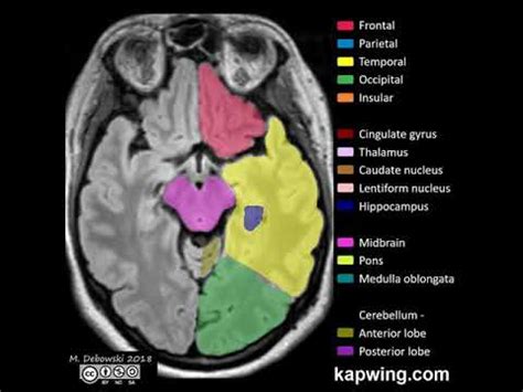 Brain Lobe Anatomy Mri