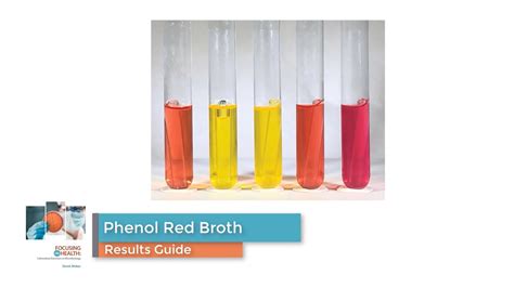 Phenol Red Color Chart