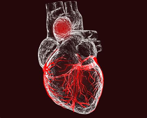 Aortic Aneurysm: Overview and More