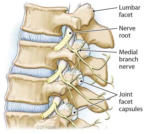 Dr. Skaribas Facet Joint Injections - Dr. Skaribas