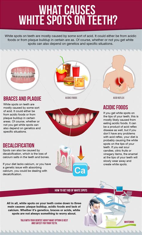 What Causes White Spots on Teeth?