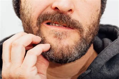 Why You Have an Itchy Beard? | Healthtian