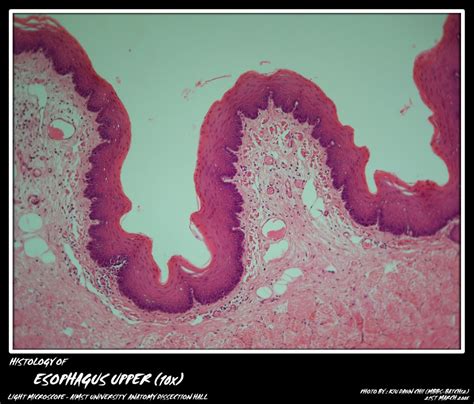 Histology: Esophagus | My Aimst University Lifestyle Blog