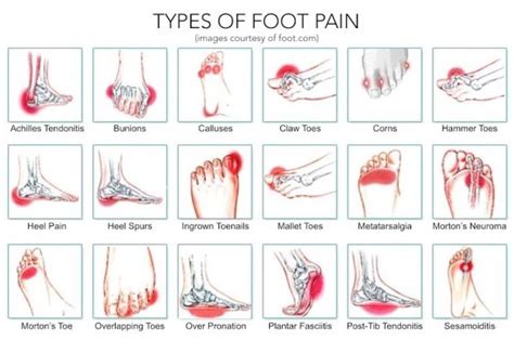 These Simple Exercises Provide Foot Pain Relief in 5 Minutes ...