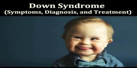 Down Syndrome (Symptoms, Diagnosis, and Treatment) - Assignment Point